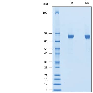 Recombinant Human CNTFR/CNTF Complex Protein SDS-PAGE