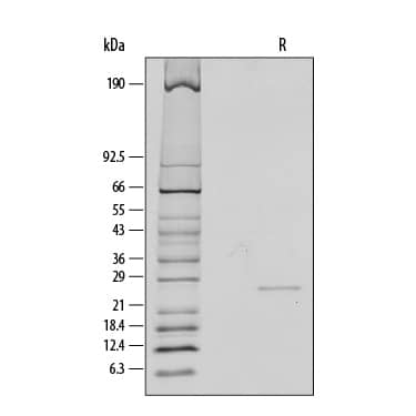 Recombinant Human CNTF Protein SDS-PAGE