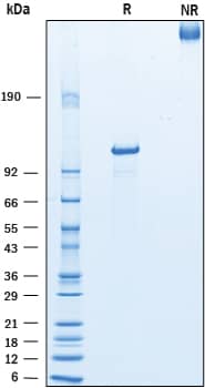 Recombinant Human COMP His-tag Protein SDS-PAGE
