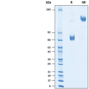 Recombinant Human CRACC/SLAMF7 Fc Avi-tag Protein SDS-PAGE