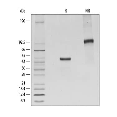 Recombinant Human CTLA-4 Fc Chimera His-tag Protein SDS-PAGE