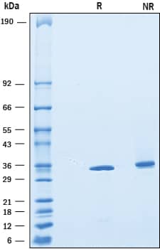 Recombinant Mouse CTRP4/C1qTNF4 His-tag Protein SDS-PAGE