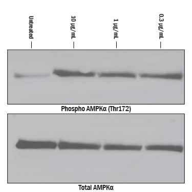 Recombinant Human CTRP5/C1qTNF5 Protein Bioactivity