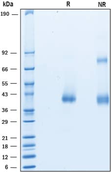 Recombinant Mouse CTRP9/C1qTNF9 His-tag Protein SDS-PAGE