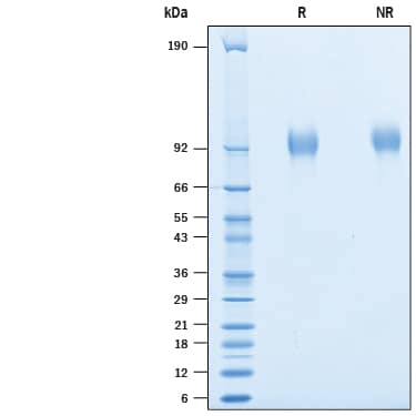 Recombinant Human CX3CL1/Fractalkine His Avi-tag Protein SDS-PAGE