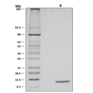 Recombinant Human CXCL10/IP-10 Protein SDS-PAGE