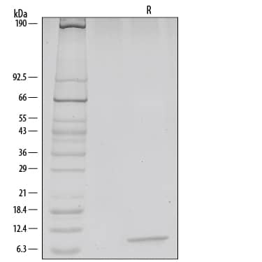 Recombinant Human/Rhesus Macaque/Feline CXCL12/SDF-1 alpha SDS-PAGE