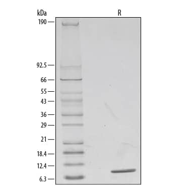 Recombinant Human IL-8/CXCL8 Protein SDS-PAGE