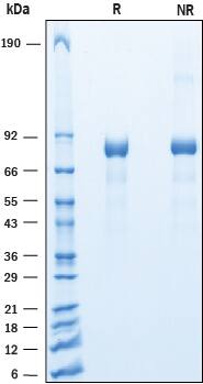 Recombinant Mouse Cadherin-9 His-tag Protein SDS-PAGE