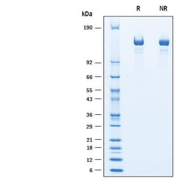 Recombinant Mouse Caspr2 His-tag Protein SDS-PAGE