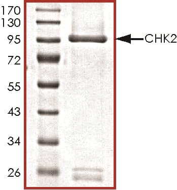 Recombinant Human Active Chk2 Protein SDS-PAGE