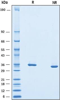 Recombinant Mouse Chondroadherin His-tag Protein SDS-PAGE