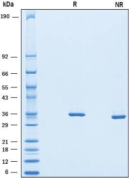 Recombinant Human Chondroadherin His-tag Protein SDS-PAGE