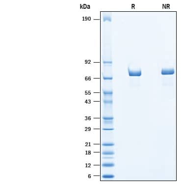 Recombinant Human Chromogranin A His-tag Protein SDS-PAGE