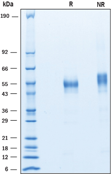 Recombinant Human Common beta Chain His-tag Protein SDS-PAGE