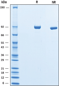 Recombinant Mouse Complement Component C3d Protein SDS-PAGE