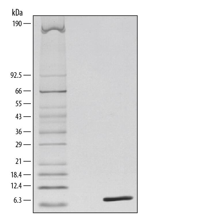 Recombinant Mouse Complement Component C5a Protein SDS-PAGE