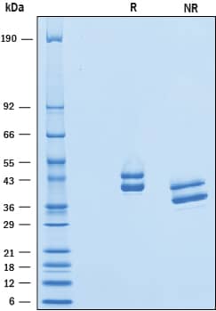 Recombinant Human Complement Factor H-related 1 His-tag SDS-PAGE