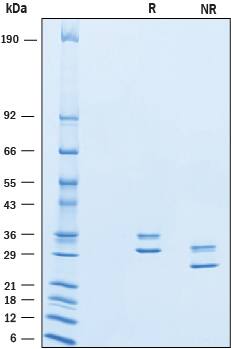 Recombinant Human Complement Factor H-related 2 His-tag SDS-PAGE
