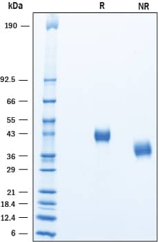 Recombinant Human Complement Factor H-related 4/CFHR4 SDS-PAGE