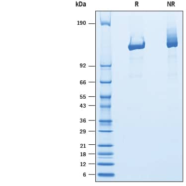 Recombinant F. tularensis Cpf1 Protein SDS-PAGE