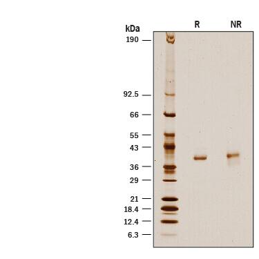 Recombinant Human D-Amino Acid Oxidase His-tag Protein SDS-PAGE