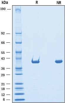 Recombinant Human Dihydroorotate Dehydrogenase Protein SDS-PAGE
