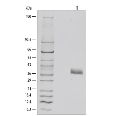 Recombinant Mouse Dkk-1 Protein SDS-PAGE