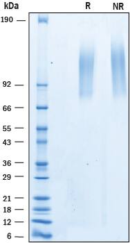 Recombinant Human ELFN1 His-tag Protein SDS-PAGE