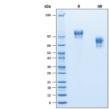 Recombinant Human E-Selectin/CD62E His-tag Protein SDS-PAGE