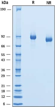 Recombinant Mouse Endorepellin His-tag Protein SDS-PAGE