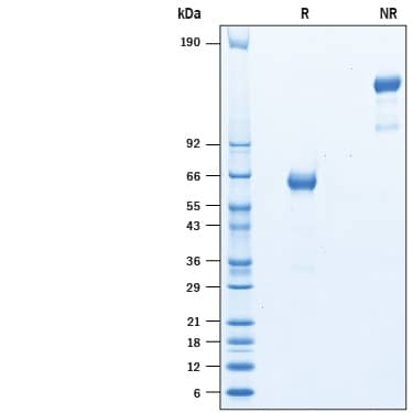 Recombinant Cynomolgus Monkey EpCAM/TROP1 Fc Protein SDS-PAGE