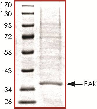 Recombinant Human Active FAK Protein SDS-PAGE