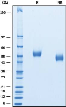 Recombinant Human FCRL4/FcRH4 His-tag Protein SDS-PAGE
