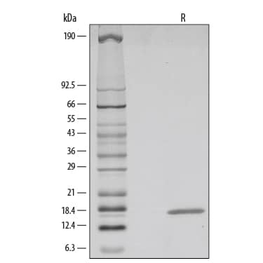 Recombinant Human FGF-4 Protein SDS-PAGE