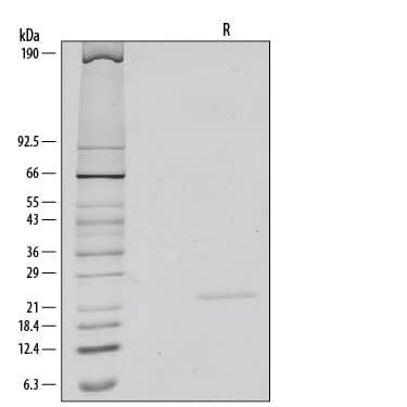 Recombinant Human/Mouse FGF-8b Protein SDS-PAGE