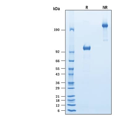 Recombinant Mouse FGFR1 Fc Chimera Protein SDS-PAGE
