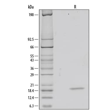 Recombinant Human FGF acidic/FGF1 (aa 2-155) Protein SDS-PAGE