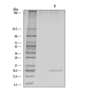 Recombinant Human FGF basic/FGF2 (146 aa) GMP Protein SDS-PAGE