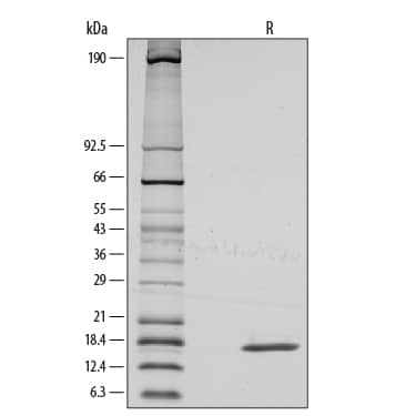 Recombinant Mouse FGF basic/FGF2/bFGF Protein SDS-PAGE