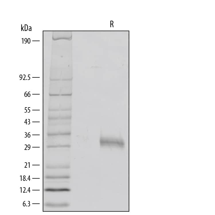 Recombinant Human Fc gamma RIIA/CD32a (R167) Protein SDS-PAGE