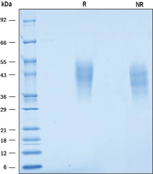 Recombinant Human Fc gamma RIIIB/CD16b (aa18-200) Protein SDS-PAGE
