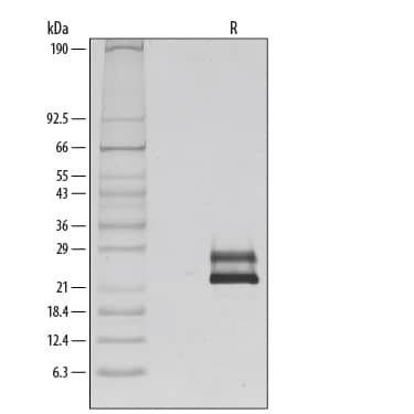 Recombinant Human Flt-3 Ligand/FLT3L Protein SDS-PAGE