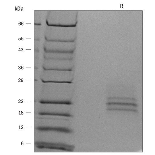 ProDots Recombinant Human Flt-3 Ligand/FLT3L Protein SDS-PAGE