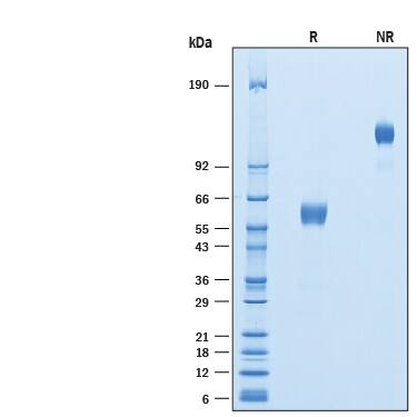 Recombinant Human Frizzled-8 Fc Biotinylated Protein SDS-PAGE