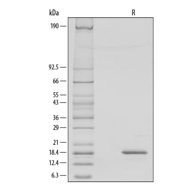 Recombinant Human G-CSF Protein SDS-PAGE