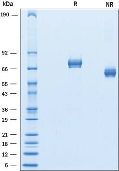 Recombinant Mouse GASP-1/WFIKKN2 Protein SDS-PAGE