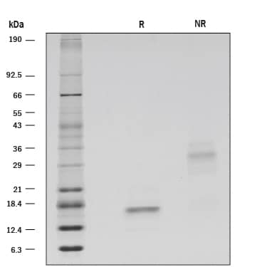 Recombinant Human GDNF GMP Protein SDS-PAGE