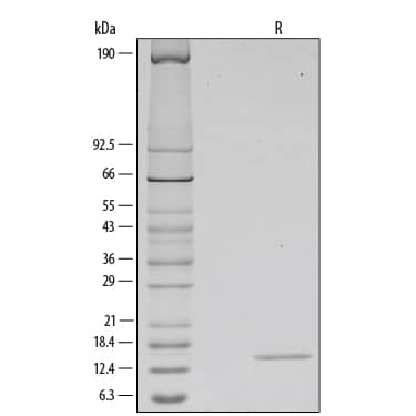 Recombinant Human GM-CSF Protein SDS-PAGE