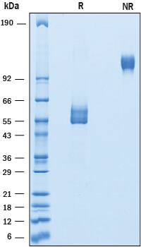Recombinant Human GPIHBP1 Fc Chimera Protein SDS-PAGE